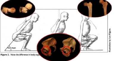 Come l’anatomia dell’anca influenza lo squat Come l’anatomia dell’anca influenza lo squat